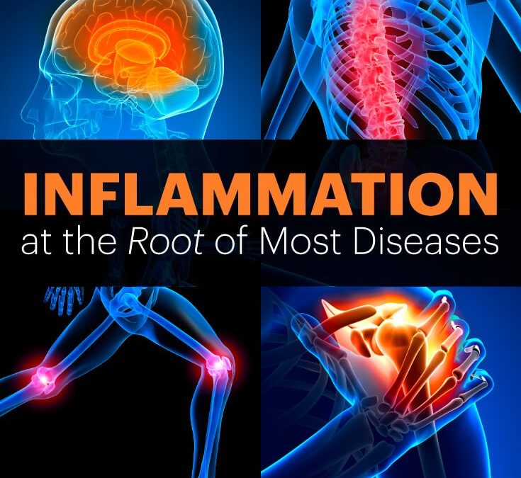 Inflammation it Weight Loss